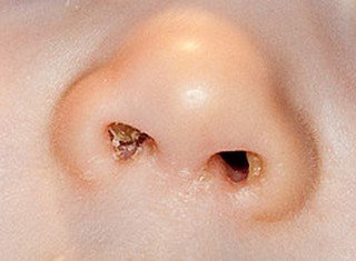 nose