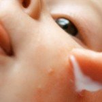 Красные пятна не теле: что это и как лечить?